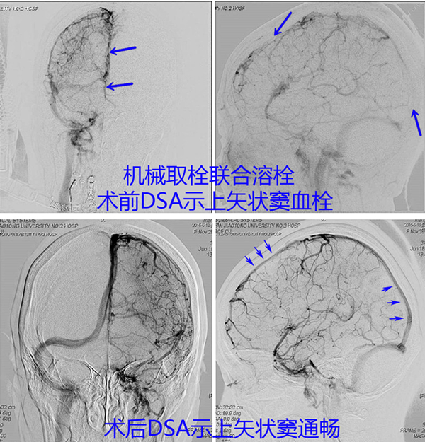 图片2_副本.png