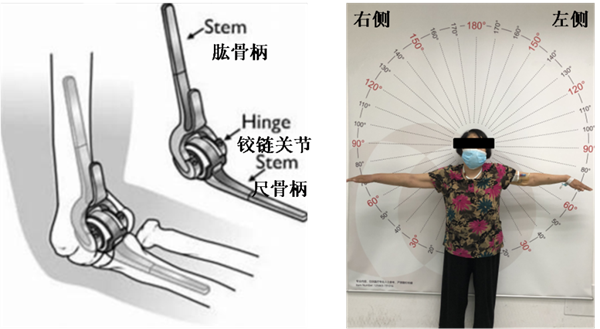 图片2_副本.png